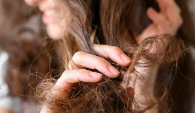 Cheveux secs et abîmés