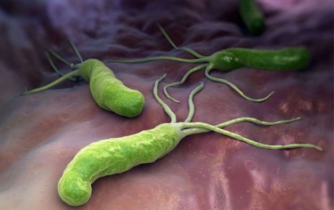 Helicobacter pylori