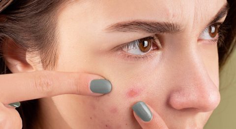 collagene-infection-inflammation-cutanee